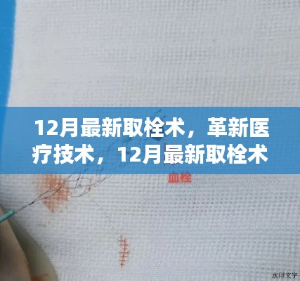 12月最新取栓术,革新医疗技术的全面介绍与评测