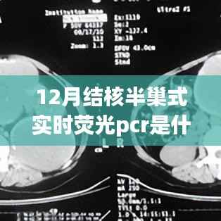 深度解析,12月结核半巢式实时荧光PCR的特性、应用及原理