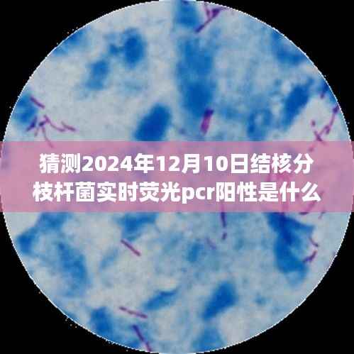 揭秘未来,结核分枝杆菌实时荧光PCR阳性检测背后的故事及意义解读(2024年12月10日)