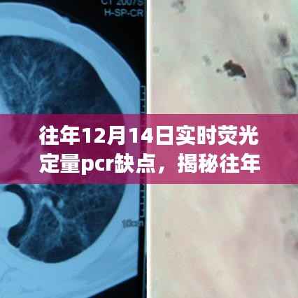 揭秘,历年12月14日实时荧光定量PCR技术的三大缺陷分析